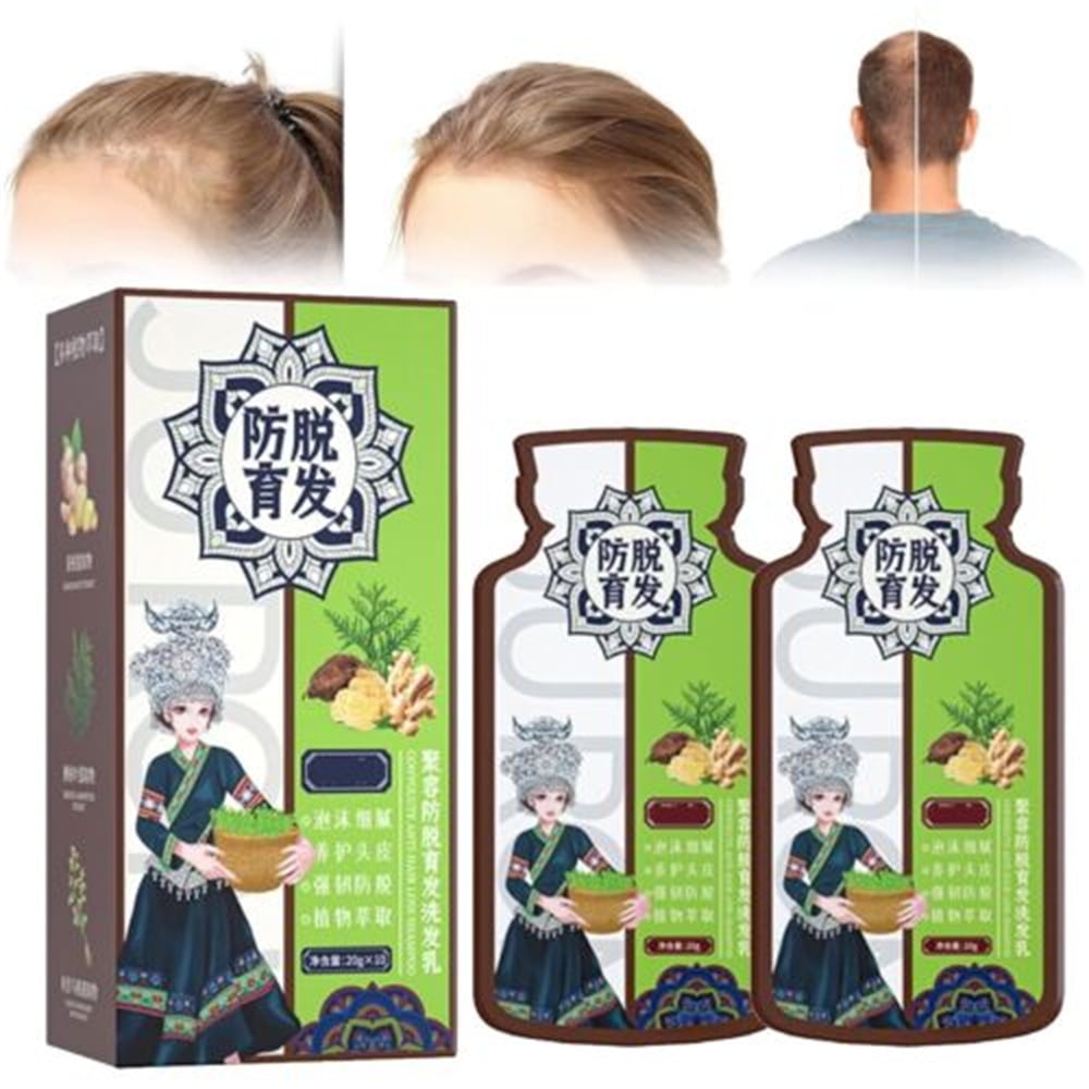 JFY Ginger AntiHair Loss Hair ShampooGinger Shampoo for Hair Growth, Smooth and Oil Control