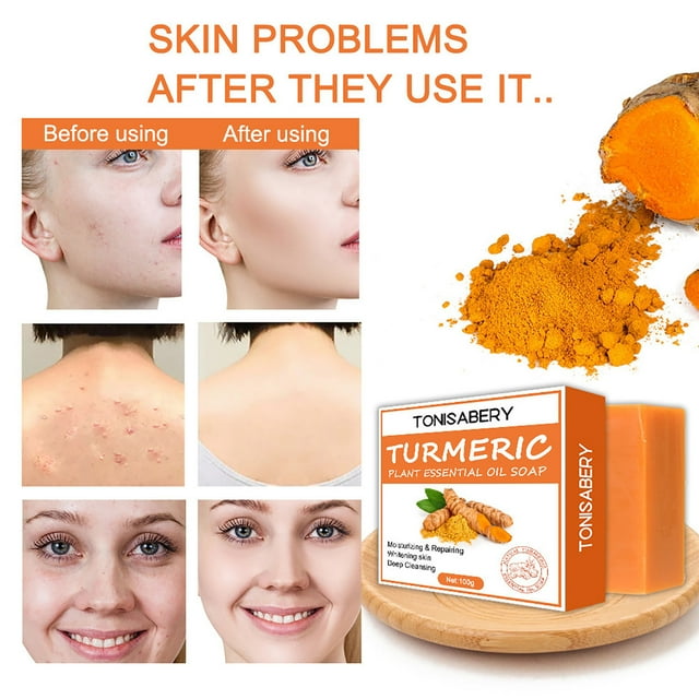 JFY Turmeric Soap Bar for Face & Body,Turmeric Brightening Soap for