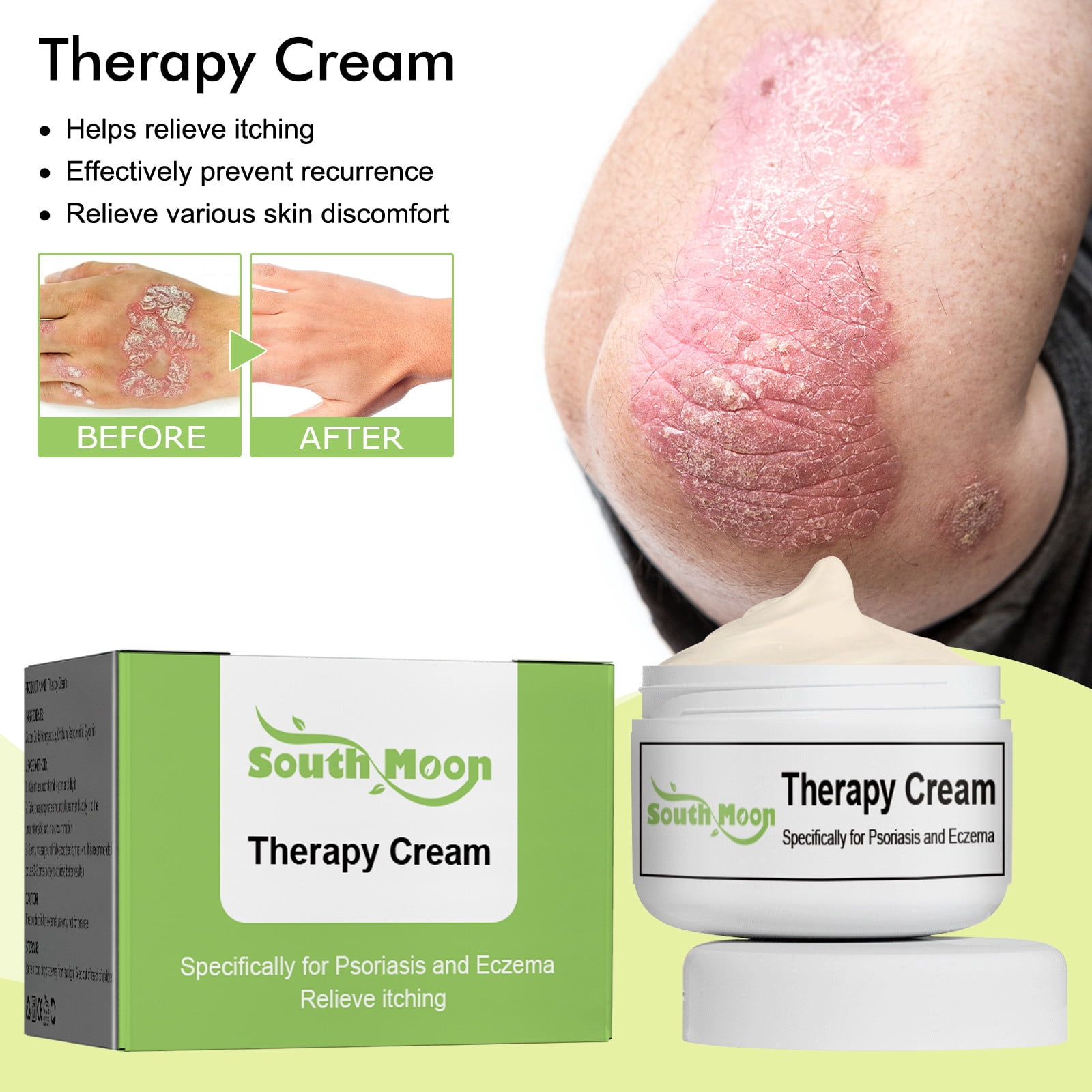 Lotion For Rashes Skin Lotion Rash
