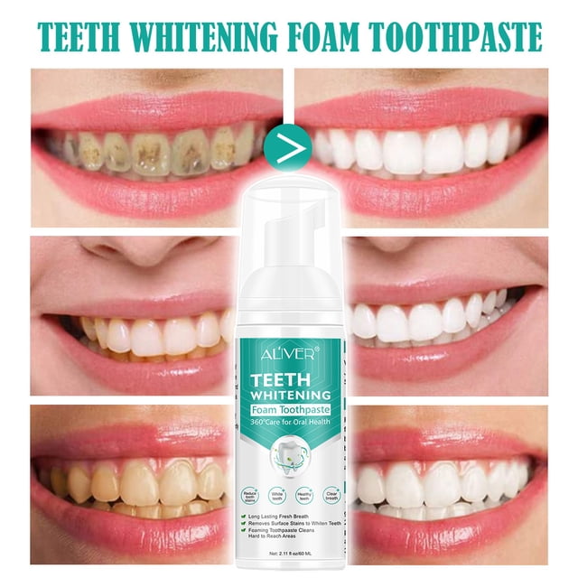 JIASONJY Tooth-Cleaning Toothpaste Teeth Whitening Oral Hygiene Teeth ...