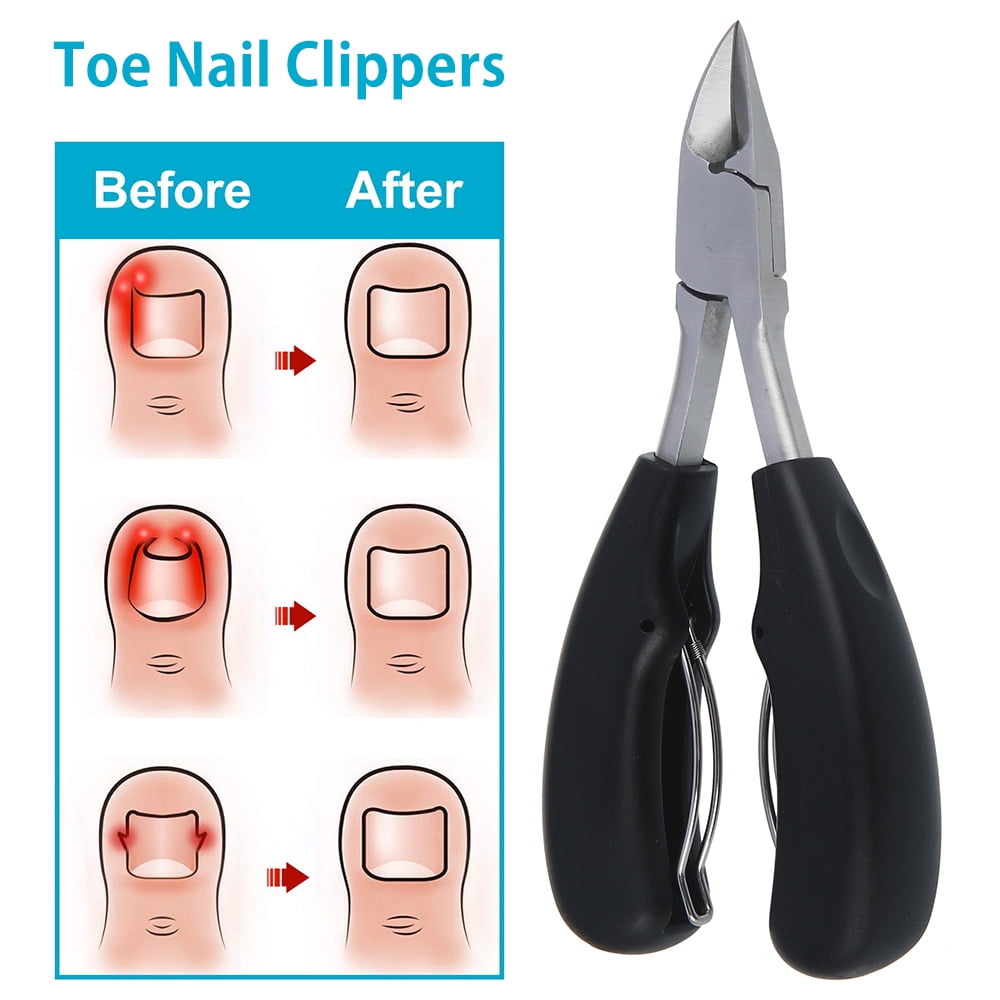 JTWEEN Toenail Clippers for Ingrown or Thick Nails,Cuticle Nipper