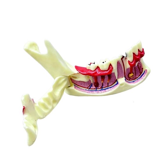 Jaw Bone Anatomy Model With Detachable Gingival ForDenta1Clinics Training