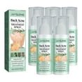 Jaysuing Back Acne Spray Back Acne Treatment Salicylic Acid Spray