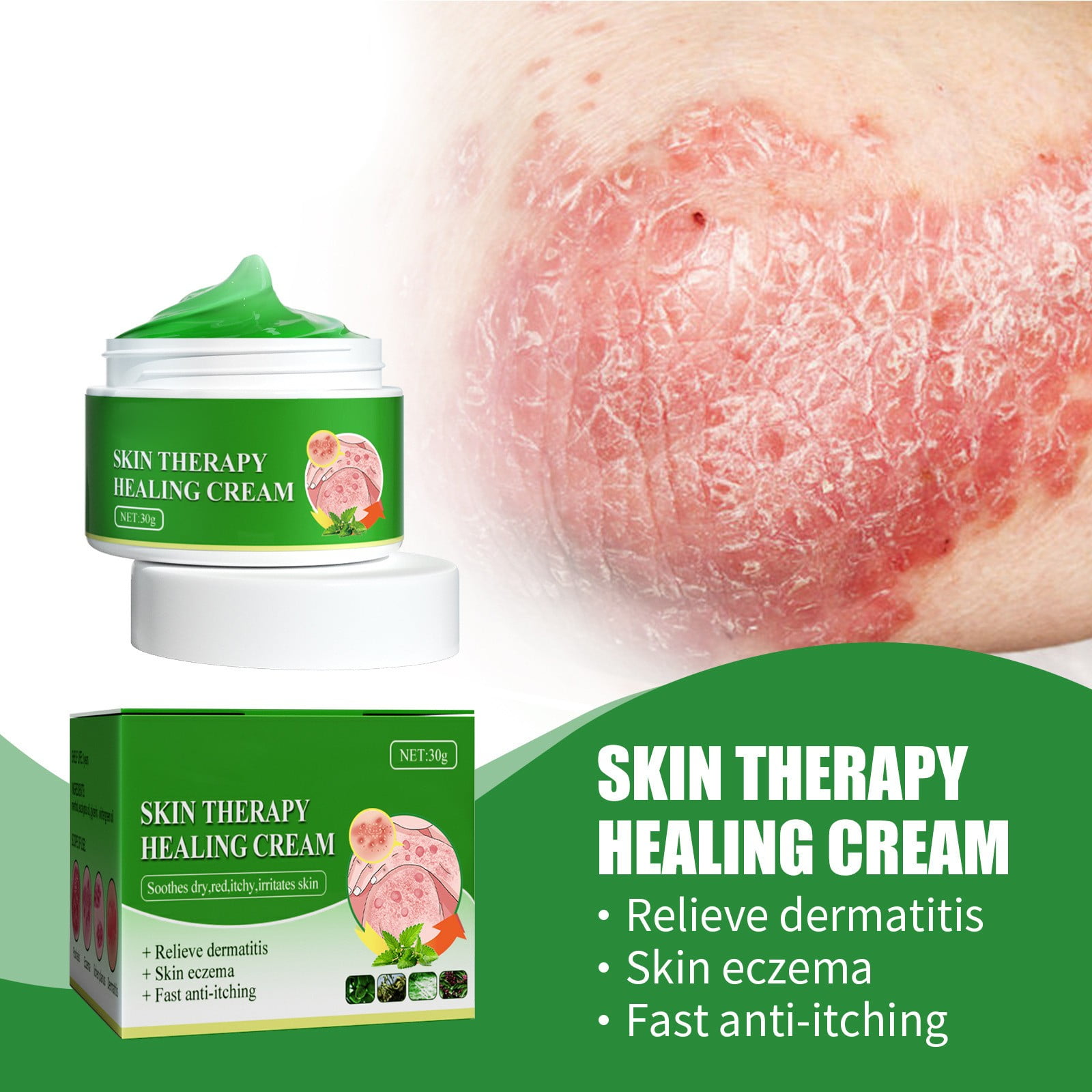 JeyDokZoy Moisturizing Skin Anainst Itch Cream,Remove Itching, Sweat Blisters, Skin Swelling