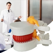 Jiyugala Home Decor Disc A Model Dentals Anatomy Prolapse Medicals Anatomical Lumbar Office Stationery