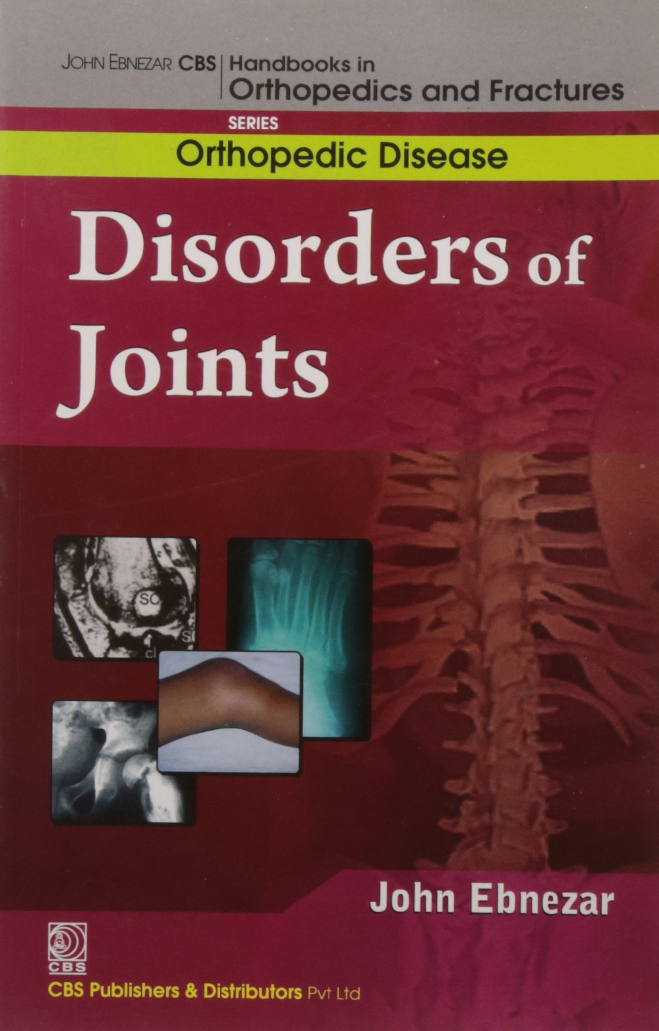 John Ebnezar CBS Handbooks in Orthopedics and Factures Orthopedic
