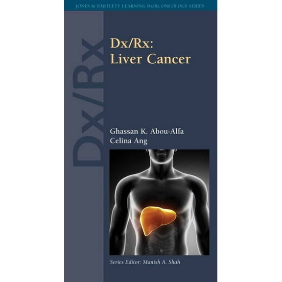 Jones & Bartlett Learning DX/RX Onco DX/Rx: Liver Cancer: ., (Paperback)