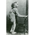 thumbnail image 1 of Joseph Merrick, The Elephant Man Poster Print by Science Source (18 x 24), 1 of 2