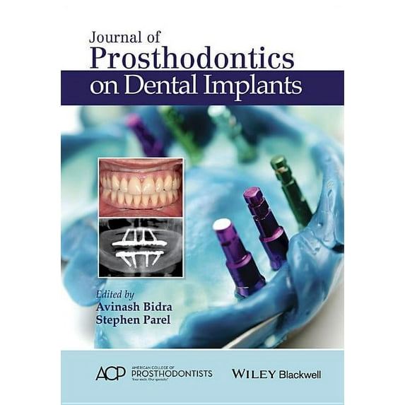 Journal of Prosthodontics on Dental Implants (Hardcover)