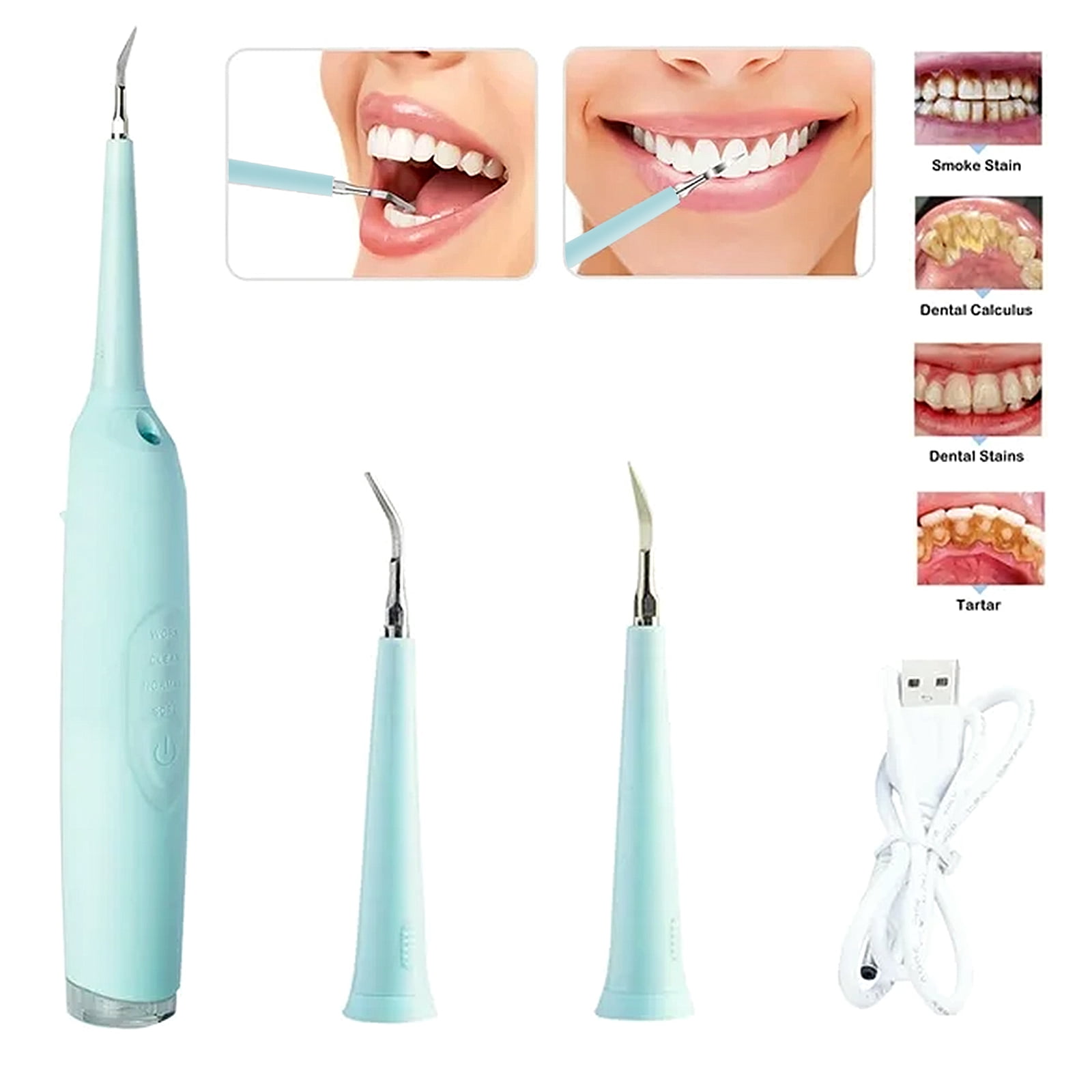 KKL Electric Dental Calculus Remover, Dental Calculus Remover Teeth Cleaning Kit with LED Light & 3Adjustable Modes