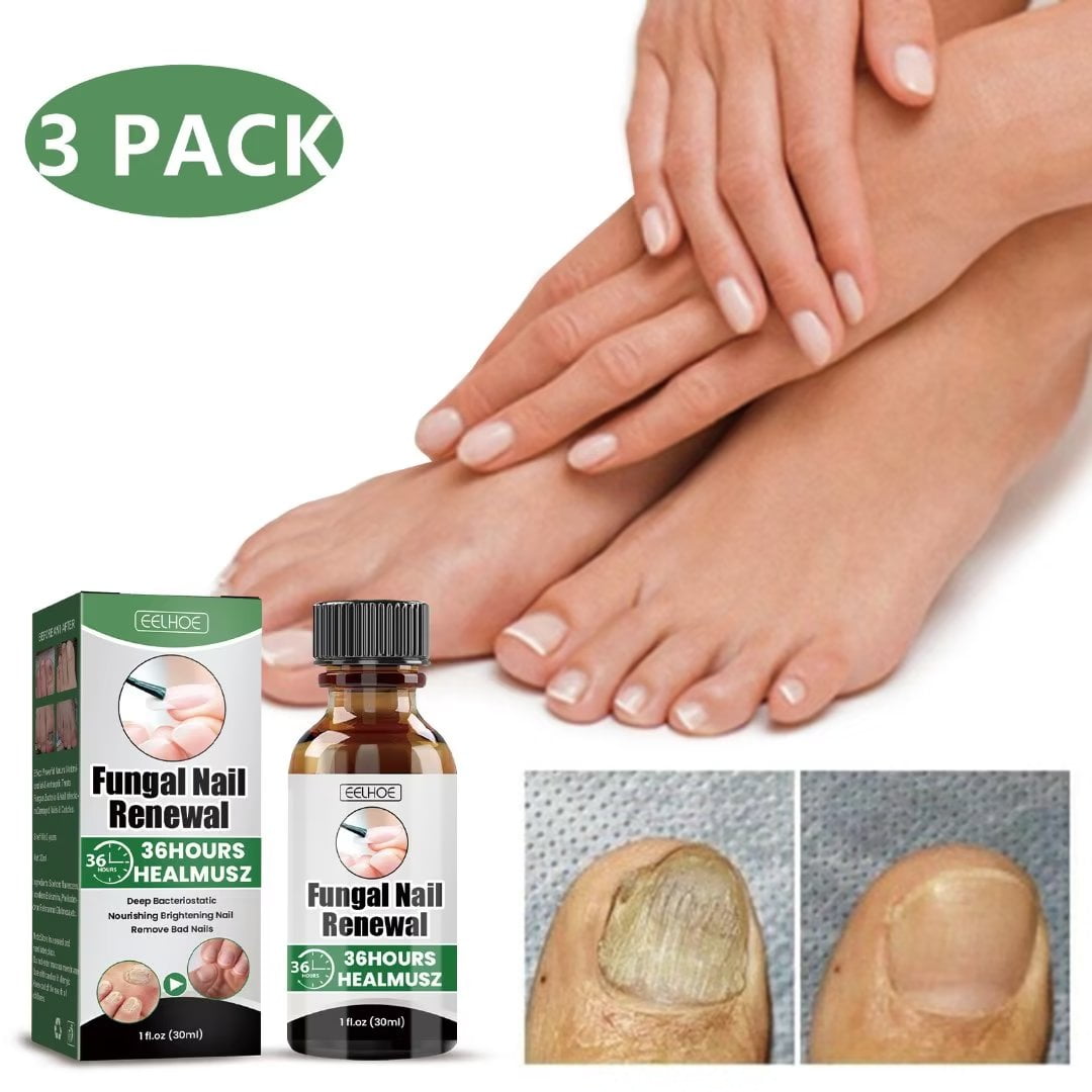 KNing 3 PACK Fun_gal Nail Renewal 30ML,Best Nail Repair Set,Extra