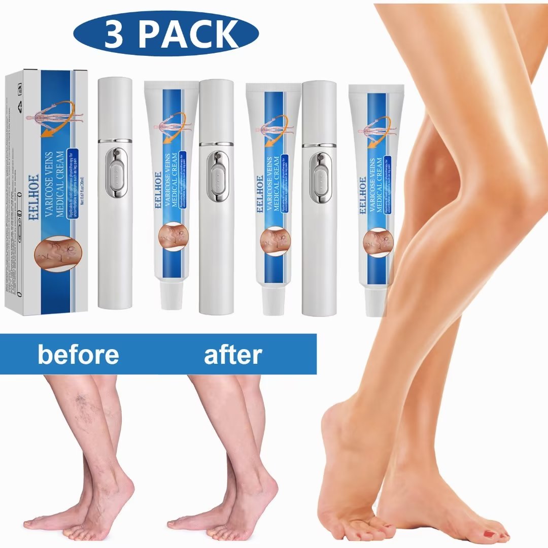 KNing 3 PACK Varicose Vein Cream with Veins Pen Blue Light Therapy