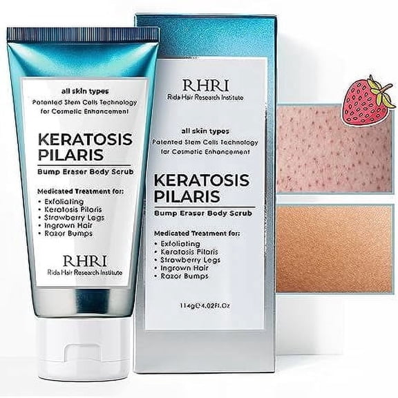 KP Bump Eraser Body Scrub, Keratosis Pilaris Treatment, Strawberry Legs Treatment for Women, Bump Eraser Body Scrub