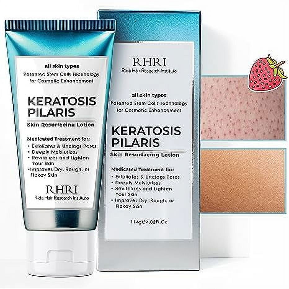 KP Bump Eraser Lotion Keratosis Pilaris Lotion with Glycolic Acid, AHA