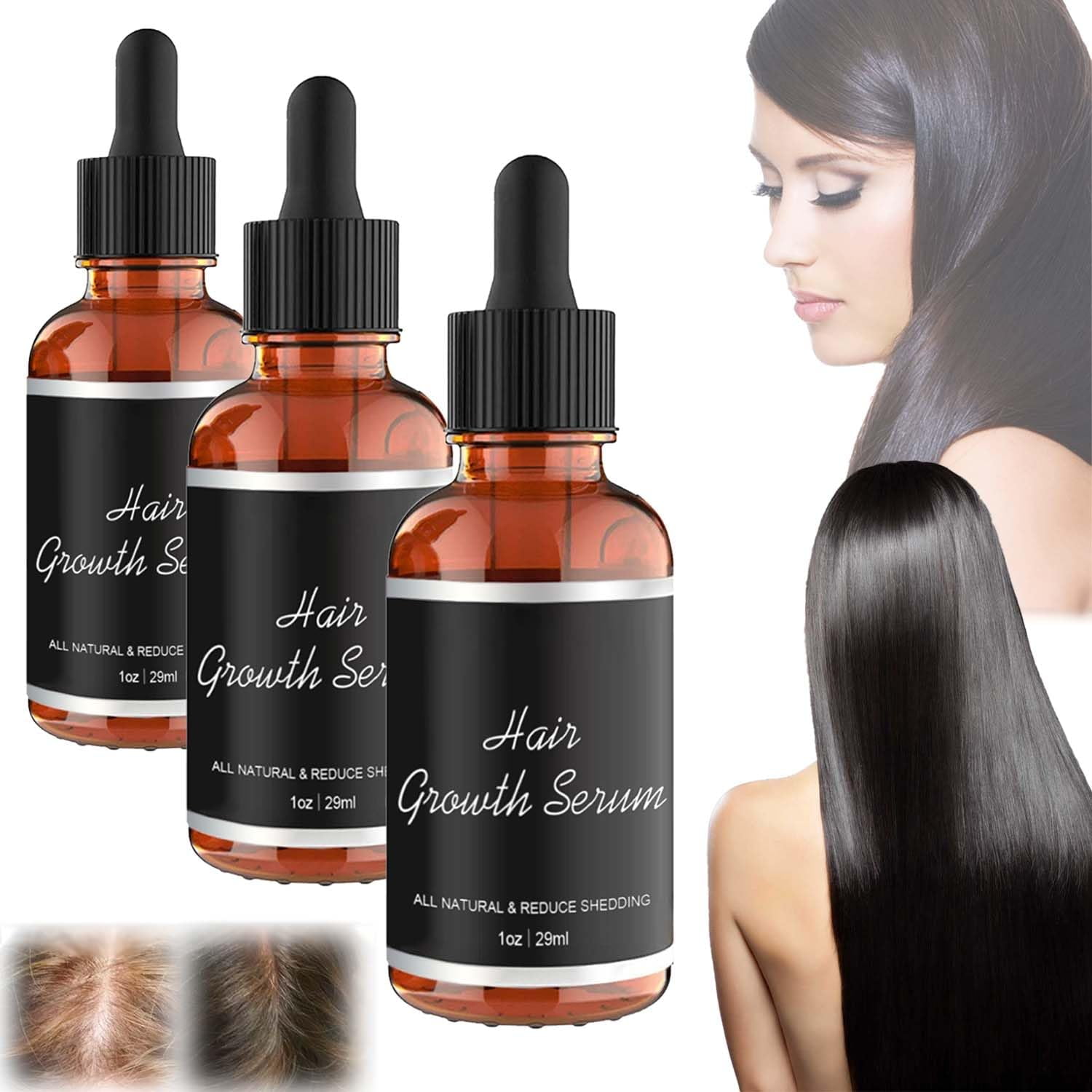 Kajiali Hair Growth Oil for Fast Hair Growth,3X Noor Hair Growth Serum