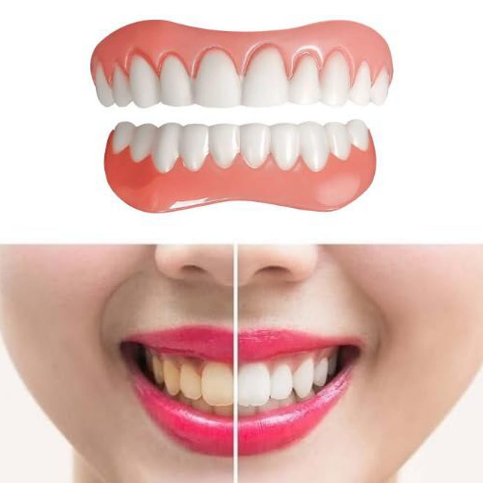 1 Bag 100g Tooth Thermal Adhesive Fitting Beads Temporary Teeth Repair  Veneer Replacement Teeth Filling Thermal Beads Denture Beads For Fake Teeth  Bro