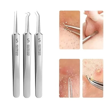 Blackhead scraper (triangle) (A) $ Stainless steel blackhead shovel ...