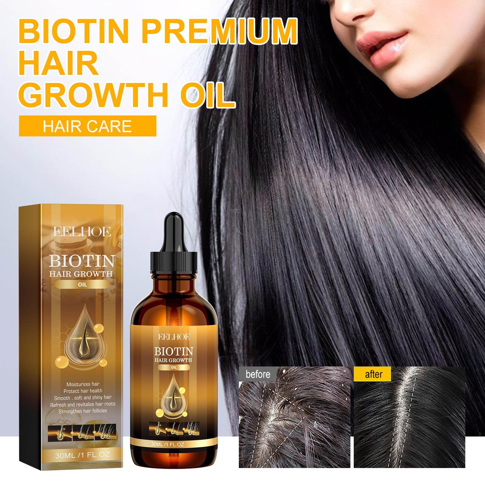 Kehuo Hair Growth Products Biotin Fast-growing Hair Essential Oil ...