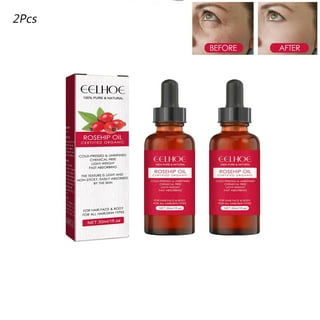 AKARZ Natural Apple Essential Oil Relax Skin Whitening Improve Sleep Acne  Treatment Apple Oil - AliExpress