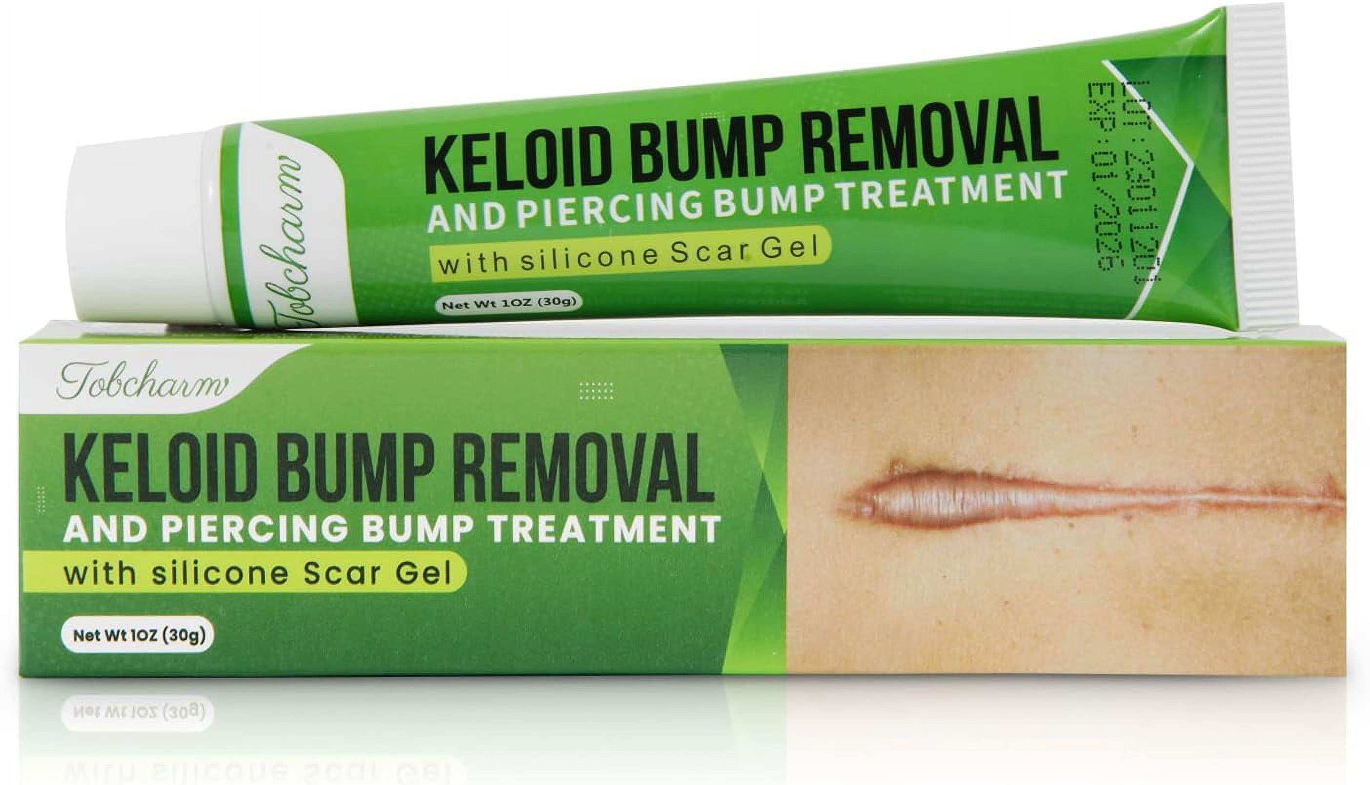 Keloid Scar Removal Cream Effective Treatment for Acne, Pimple, Surgery & Piercing Scars