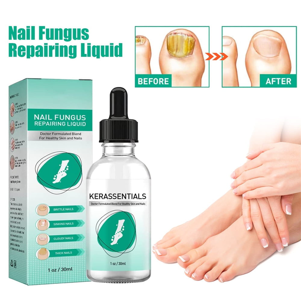 Kerassentials Extra Strength Toenail Fungus Treatment Oil for Damaged and Discolored Nails - Walmart.com
