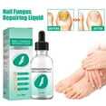 Kerassentials Extra Strength Toenail Fungus Treatment Oil for Damaged and Discolored Nails