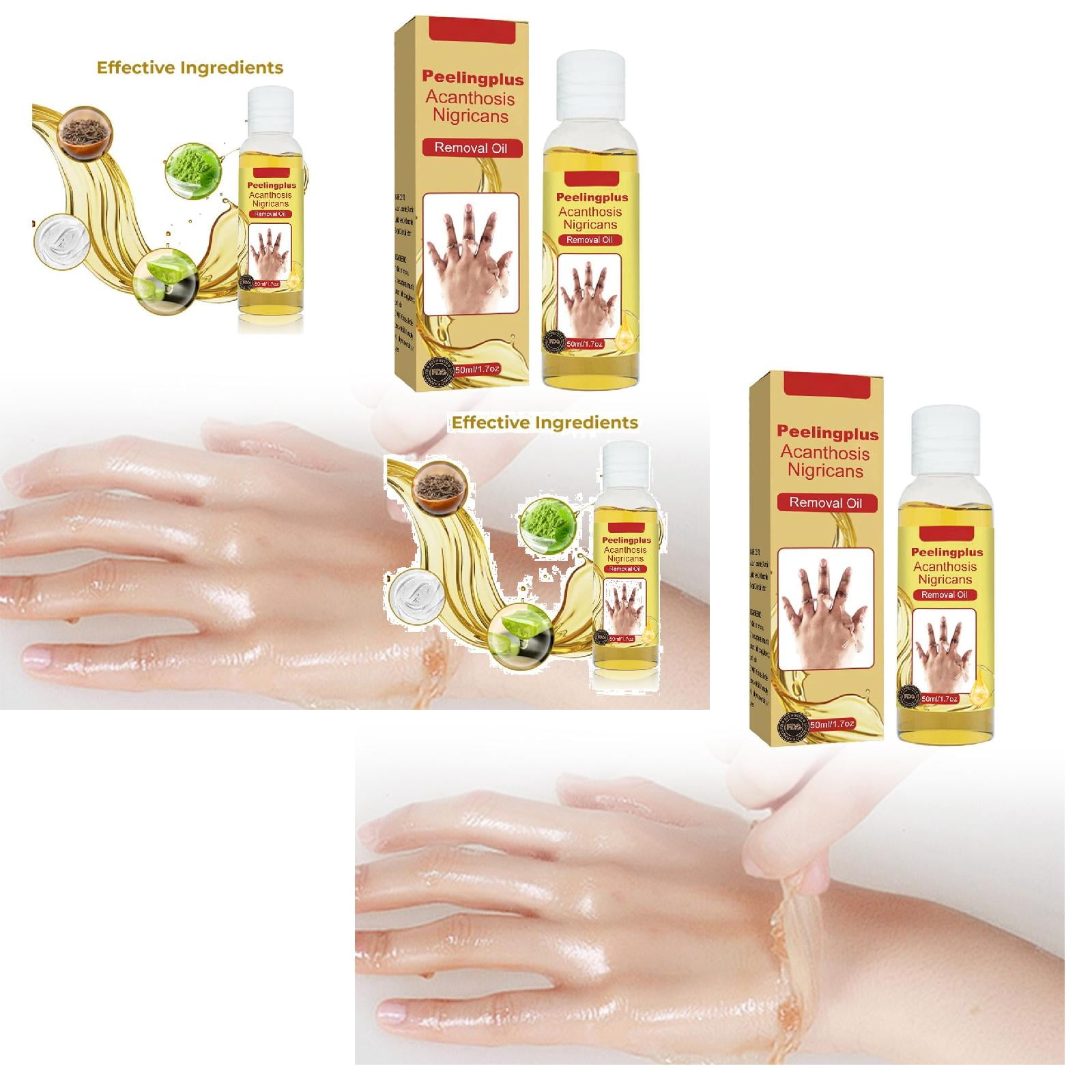 Keratosis Exfoliating Oil Underarms Knees Elbows Joints Brighten Skin