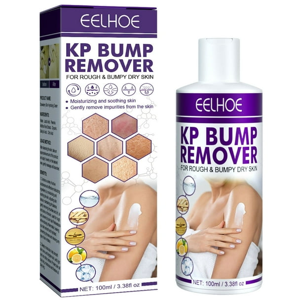 Keratosis Pilaris Repair Cream Natural Ingredients Exfoliating Cream for Folliculitis Skin Treatment Walmart Business Supplies