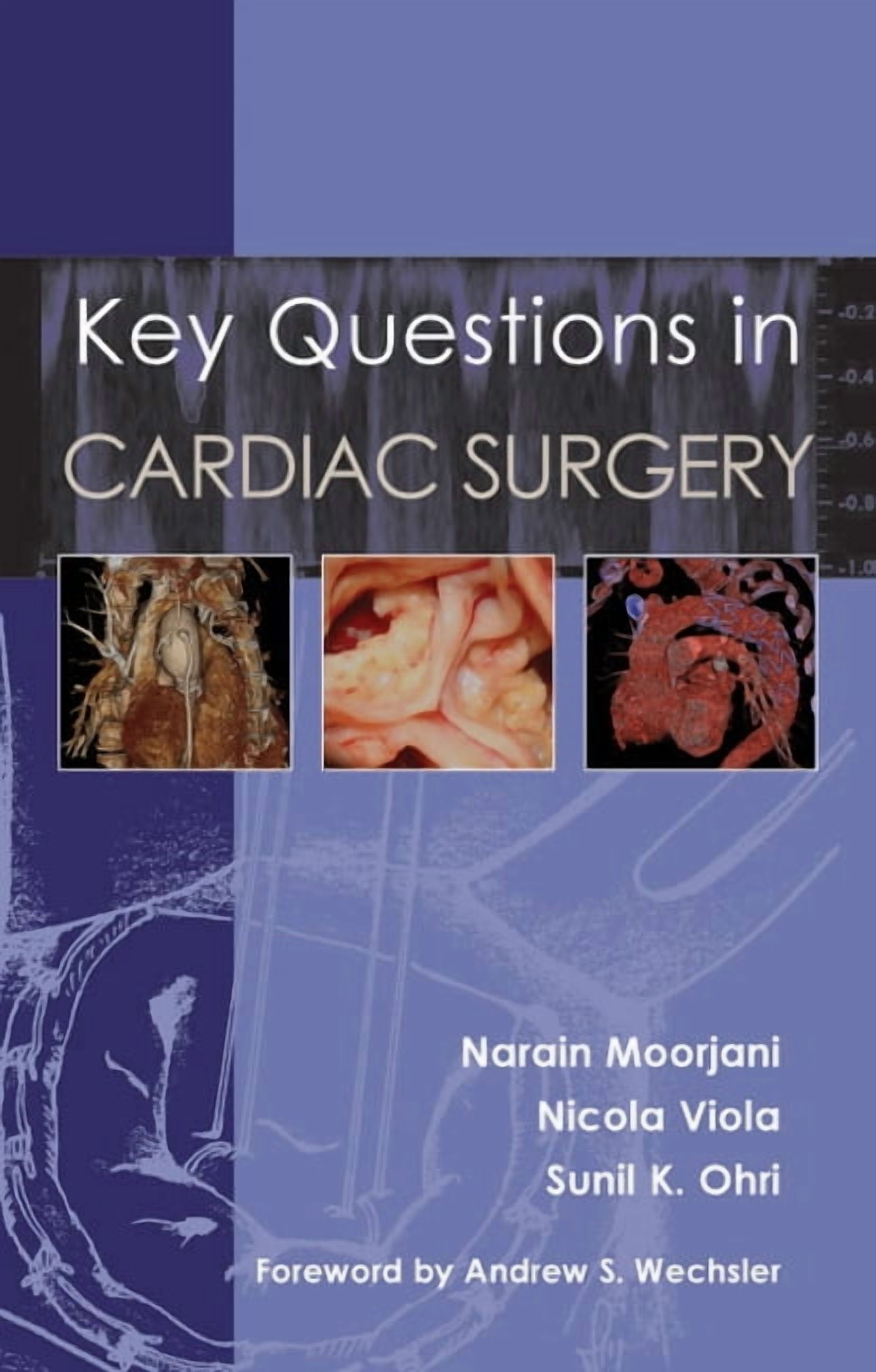 Key Questions in Cardiac Surgery (Paperback)