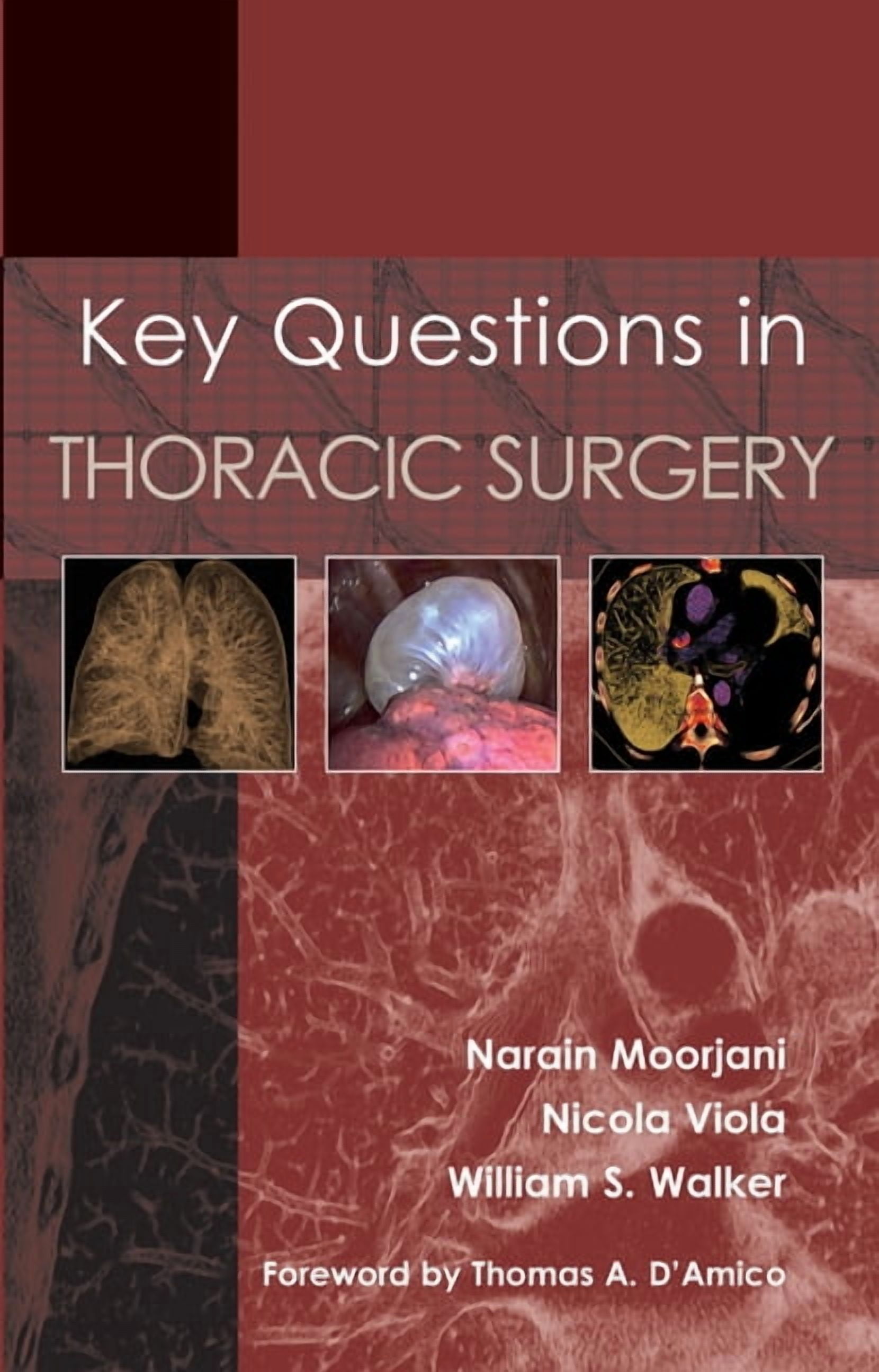 Key Questions in Thoracic Surgery (Paperback)