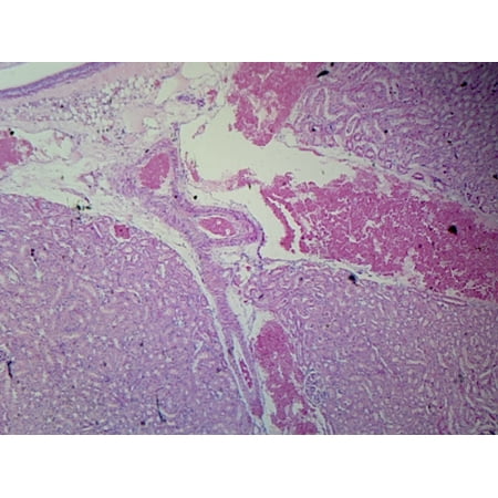 Kidney, Mammalian; Longitudinal Section; Showing Renal Pelvis, Calyces, Cortex, and Medulla by Go Science Crazy