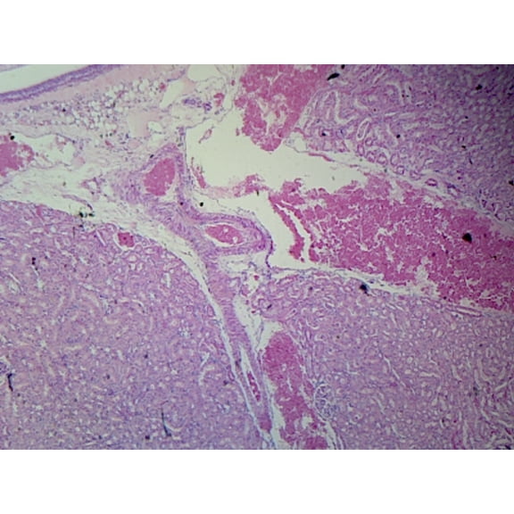 Kidney, Mammalian; Longitudinal Section; Showing Renal Pelvis, Calyces, Cortex, and Medulla by Go Science Crazy