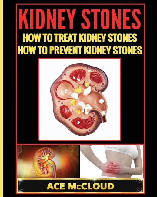 Kidney Stones: How To Treat Kidney Stones: How To Prevent Kidney Stones ...