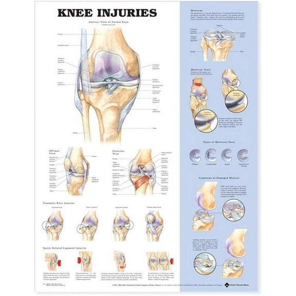 Knee Injuries Anatomical Chart (Other)
