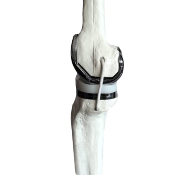 Knee Joint Model Simulation Replacement Surgery Meniscus Ligament Cartilages Surgery Model,Artificial Knee Joint