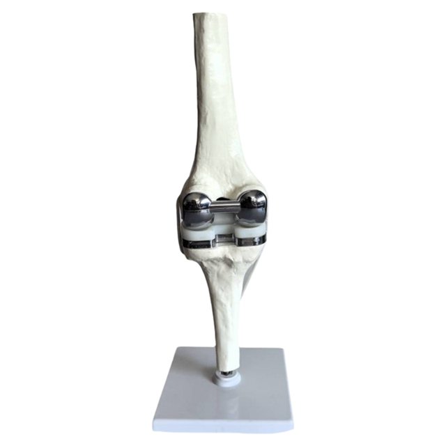 Knee Joint Model Simulation Replacement Surgery Meniscus Ligament