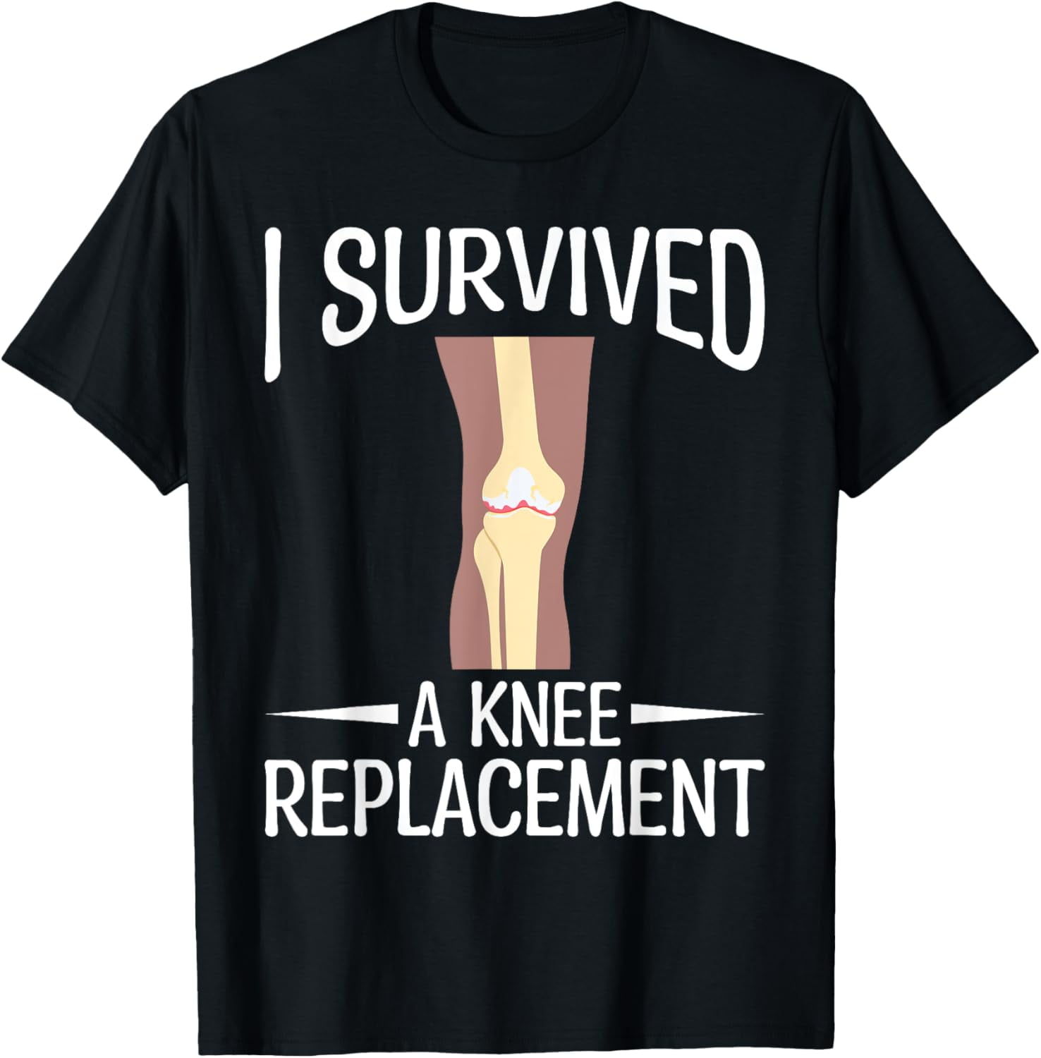 Knee Replacement Surgery I Survived A Knee Replacement TShirt