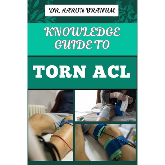 Knowledge Guide to Torn ACL: Essential Manual To Symptoms, Treatment Options, Recovery Exercises, And Prevention Strateg, (Paperback)