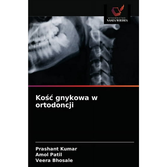 Kośc gnykowa w ortodoncji (Paperback)
