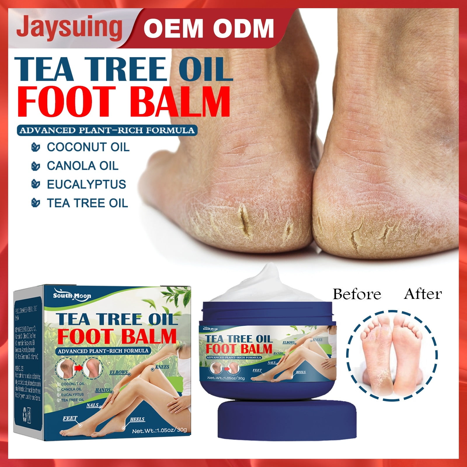 Home Remedies for Cracked Heels: Your Key to Flawless Feet – Derma Essentia