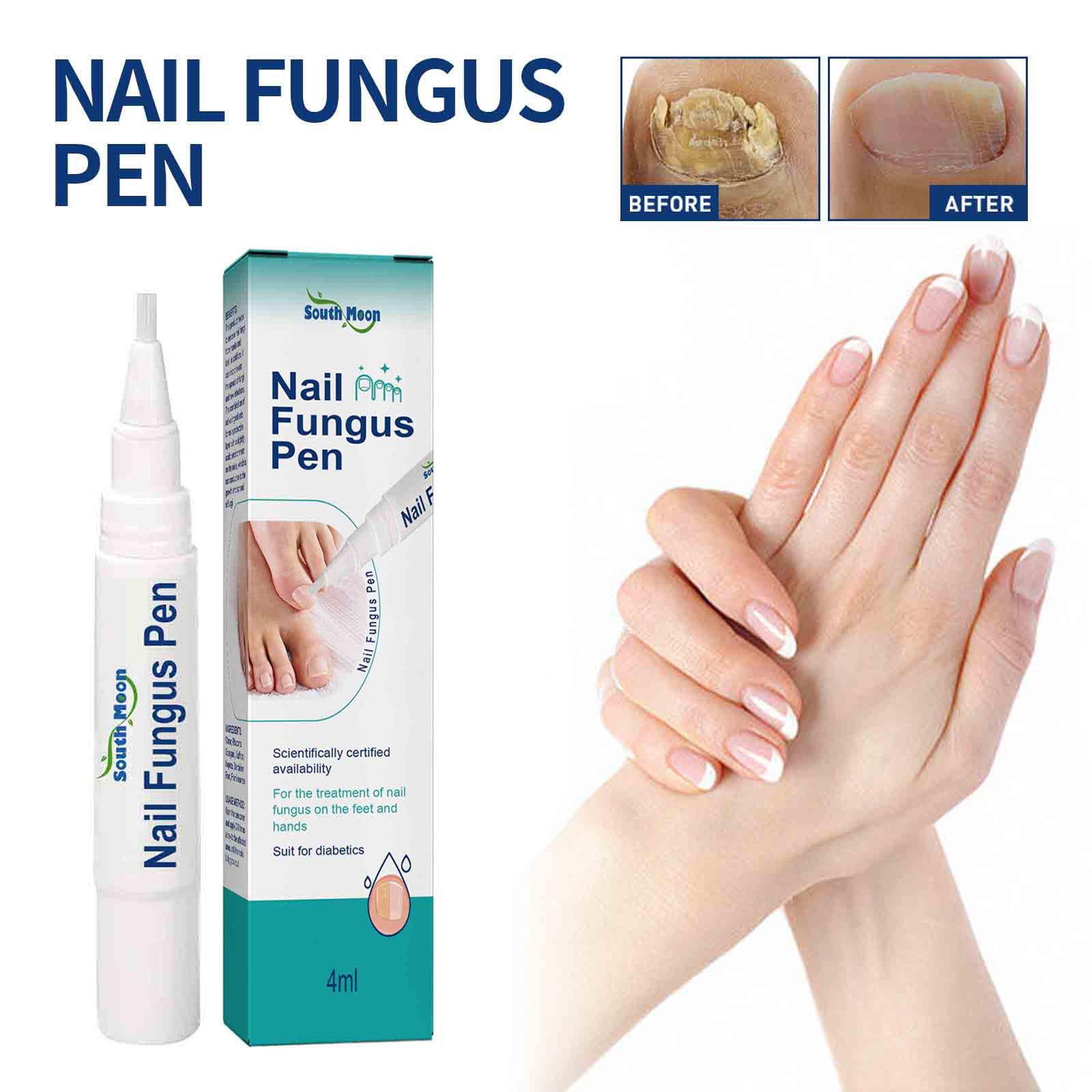 Kokovifyves Beauty Products Sale Nail Repair Pens and Toenail Repair