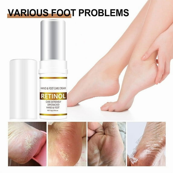 Kokovifyves Retinol Heel Dry and Cracked Foot Cream Moisturizing Hand Cream Removing Dead and Restoring Cracks Cream 2.8g