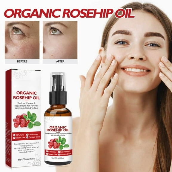 Kokovifyves Rose Hip Oil Repair Skin Care Facial Moisturizing and Rejuvenating 30ml