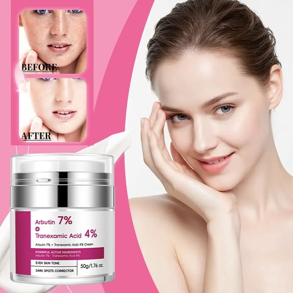 Kokovifyves Tranexamic Face Cream for Dark Spots Freckle Blemishes Pigmentation Care for Hyperpigmentation 50g