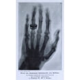 thumbnail image 1 of Konrad Roentgen'S X-Ray Of The Hand Of Professor Albert Von Kolliker History (24 x 36), 1 of 2