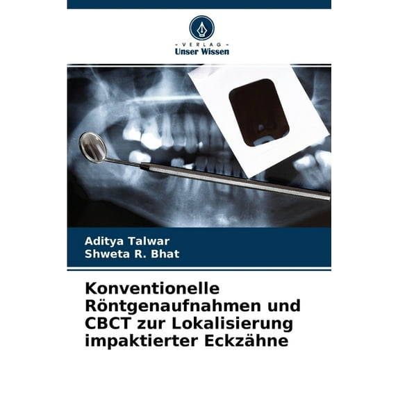 Konventionelle Röntgenaufnahmen und CBCT zur Lokalisierung impaktierter Eckzähne (Paperback)