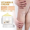 Kor New Varicose Veins Miracle Cream, Varicose Vein Cream, Vitamin K