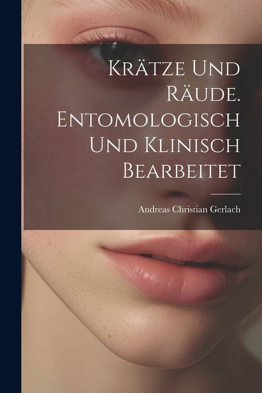 Krätze und Räude. Entomologisch und klinisch bearbeitet (Paperback) - image 1 of 1