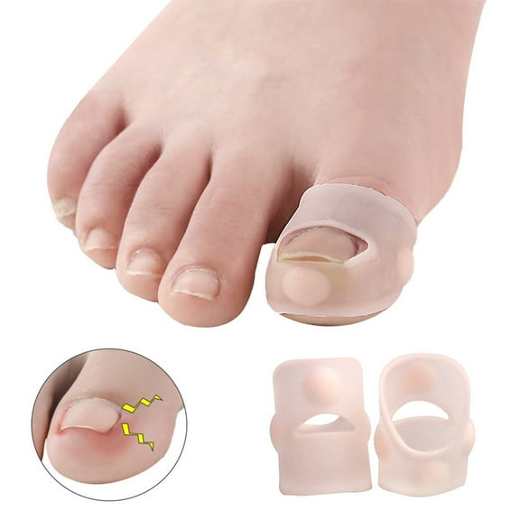 Kripyery 1 Pair Anti-toe Ingrown Device Ingrown Nail Correction Silica Gel Relief Inflammation Toenail Correction for Beauty Salon