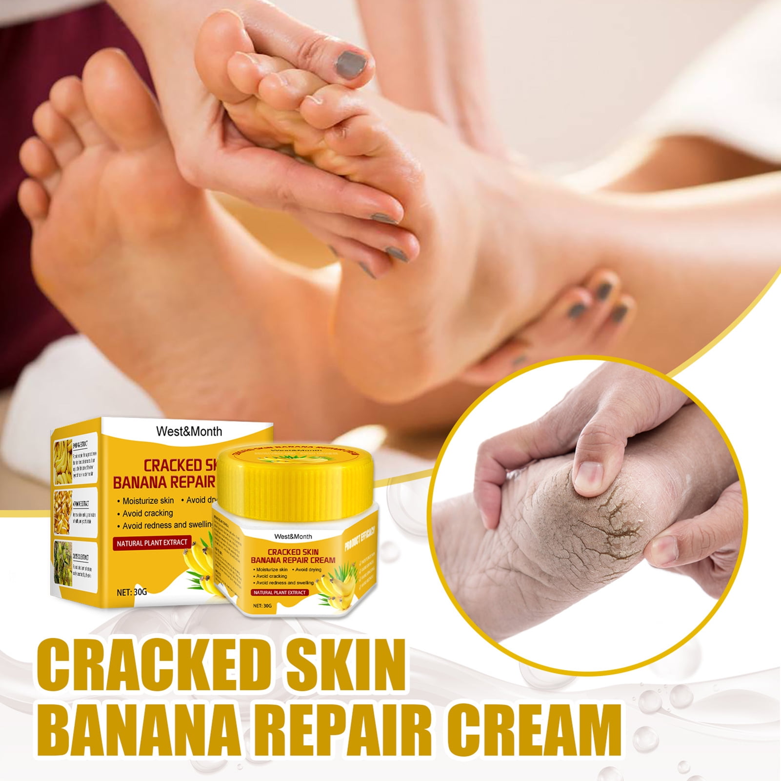 U Heel Cream With Activate Repair Moisturiser, Heals, Soothes Visible  Results on 3 Days Pack of 2 - Walmart.com